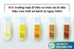 Tiểu ra máu ở nam giới và những điều cần biết